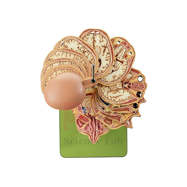 Horizontally Sectioned Model of the Human Head